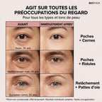 BIOPHOX EYE — Tenseur Regard Instantané